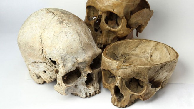 Zbirka vključuje tudi koščke človeške lobanje. Foto: Mini Museum