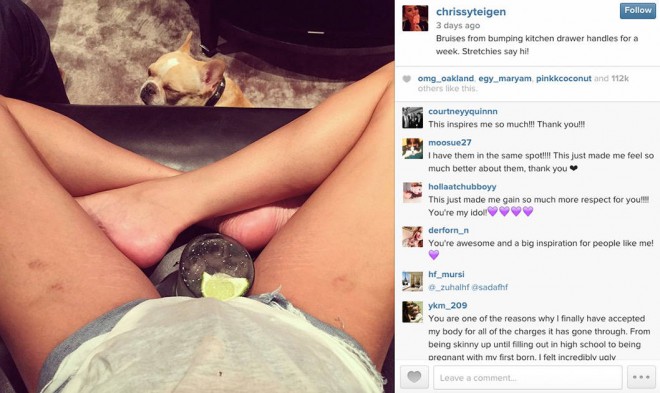 لذلك شاركت Chrissy Teigen صورة لعلامات التمدد على شبكة التواصل الاجتماعي Instagram.