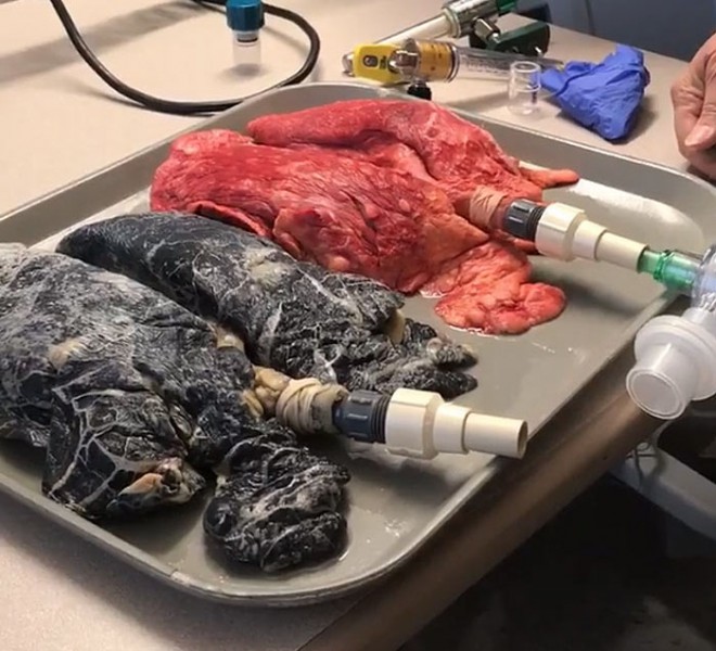 Healthy and destroyed lungs.