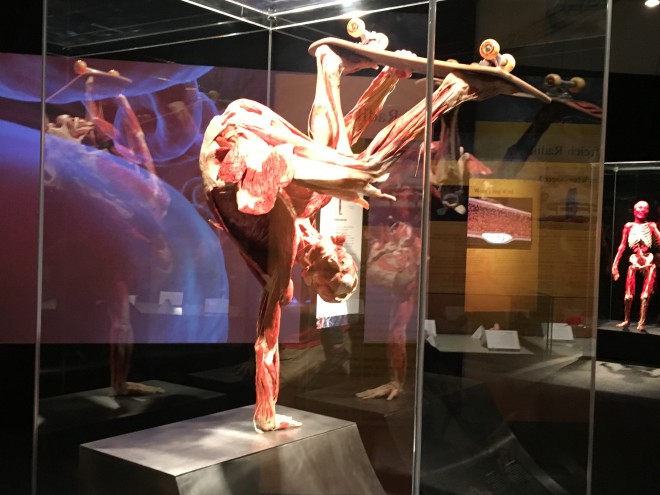 Die vollständige Plastination eines menschlichen Körpers dauert etwa 1.500 Stunden. 