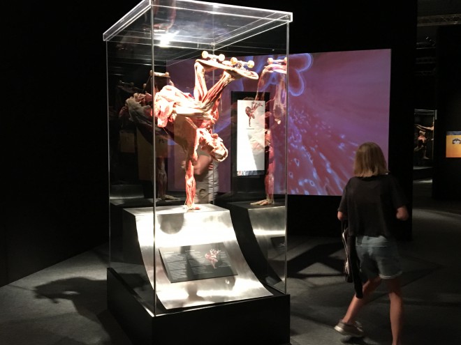 Plastination ist ein Verfahren oder eine Technik, die verwendet wird, um den Verfall eines menschlichen Körpers nach dem Tod zu verhindern. 